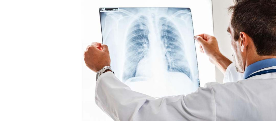 Krótkie terminy oczekiwania na chemioterapię! Prowadzimy wielokierunkową diagnostykę i leczenie wszystkich nowotworów płuc i innych nowotworów klatki piersiowej!